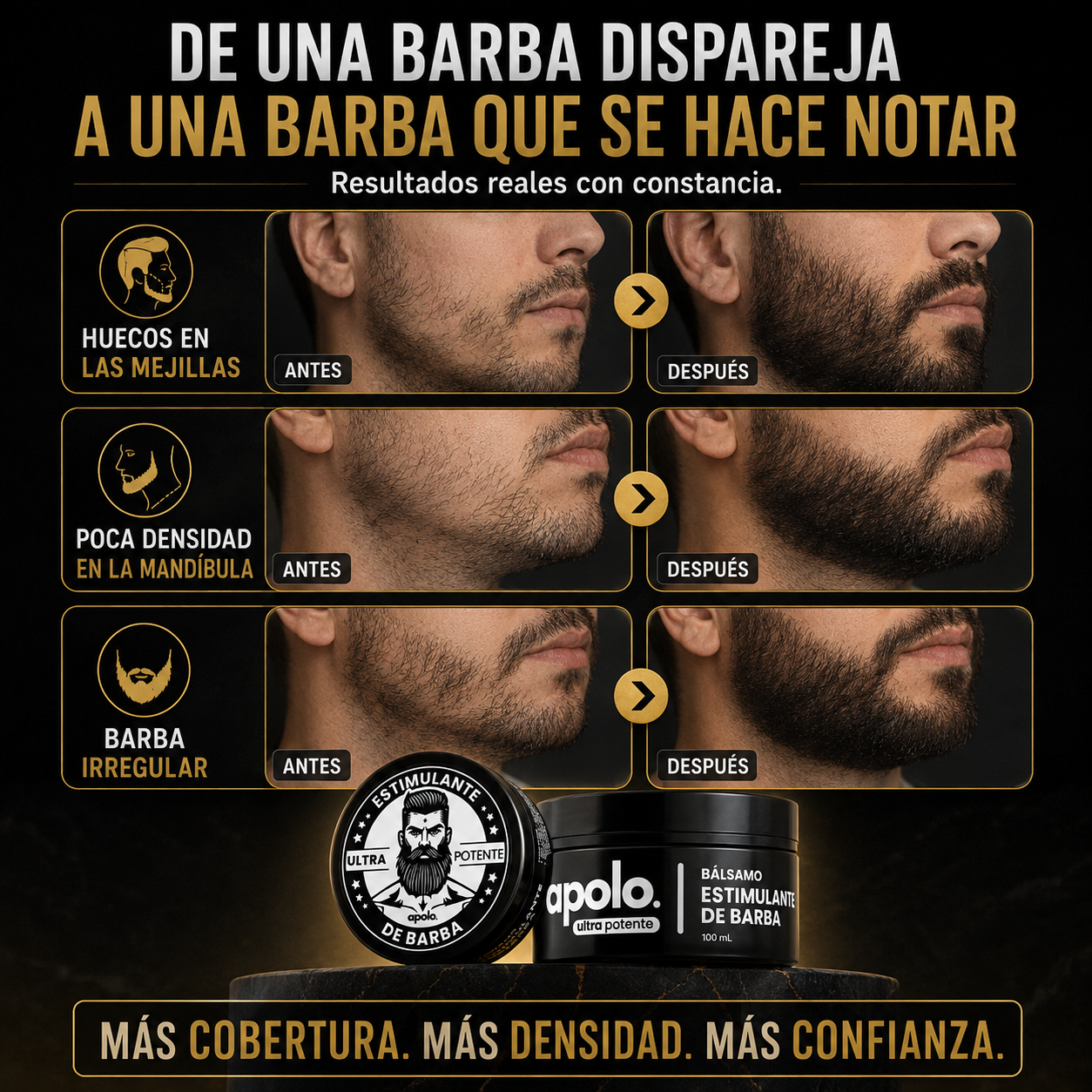 Apolo Ultra Potente™ | Fórmula Intensiva con Minoxidil 20% para una Barba Más Densa y Uniforme