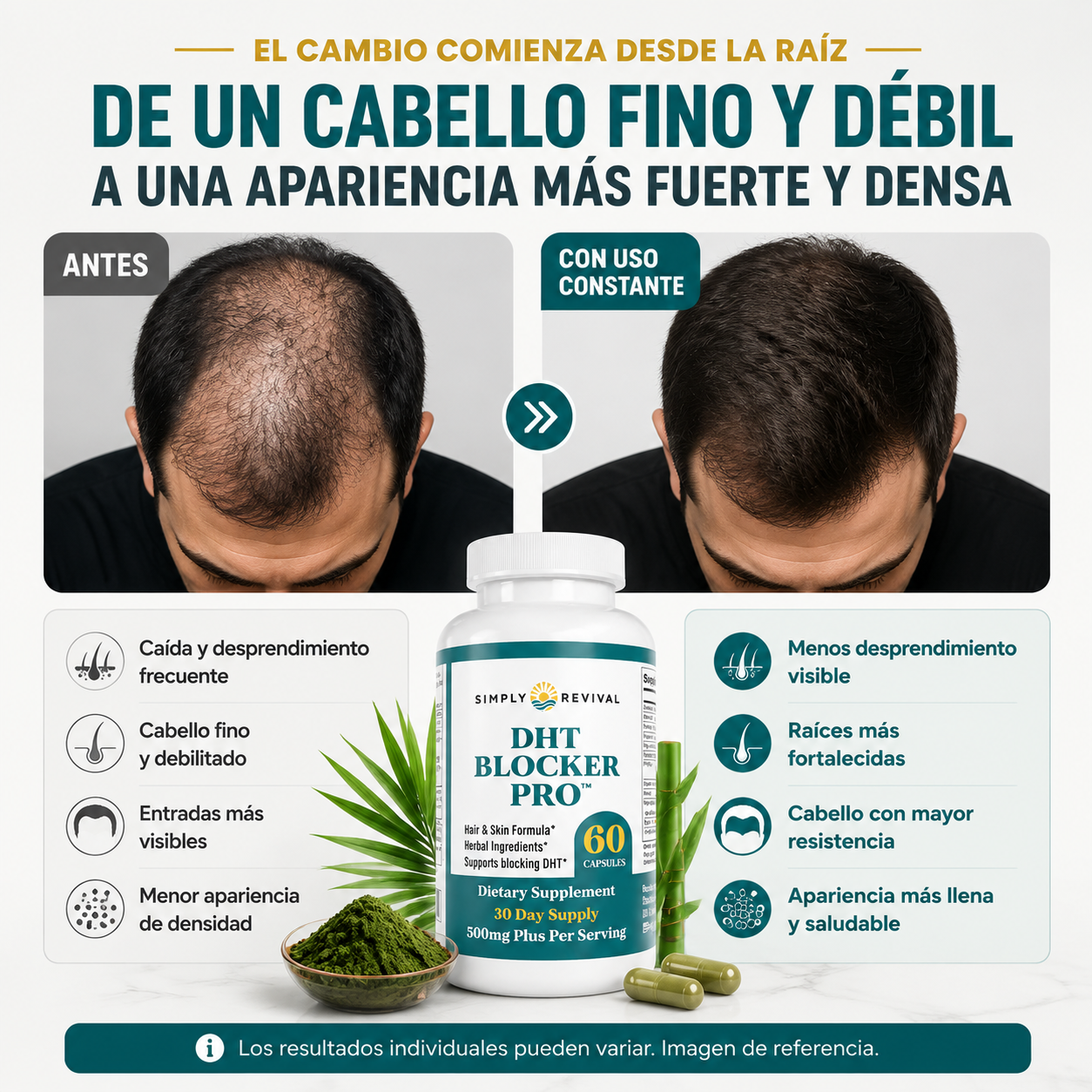 DHT BLOCKER PRO™ Fórmula importada anticaída para hombres que quieren ayudar a detener la caída, entradas y cabello delgado