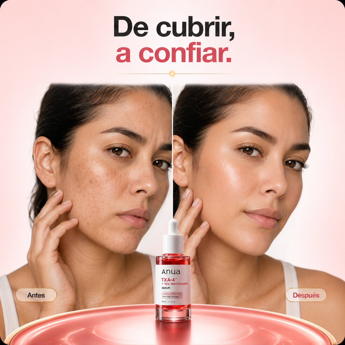 Serum Anua TXA-4™ + 10 Niacinamida: Bálsamo Coreano: Reduce la Apariencia de Manchas y Corrige el Tono Desigual de la piel
