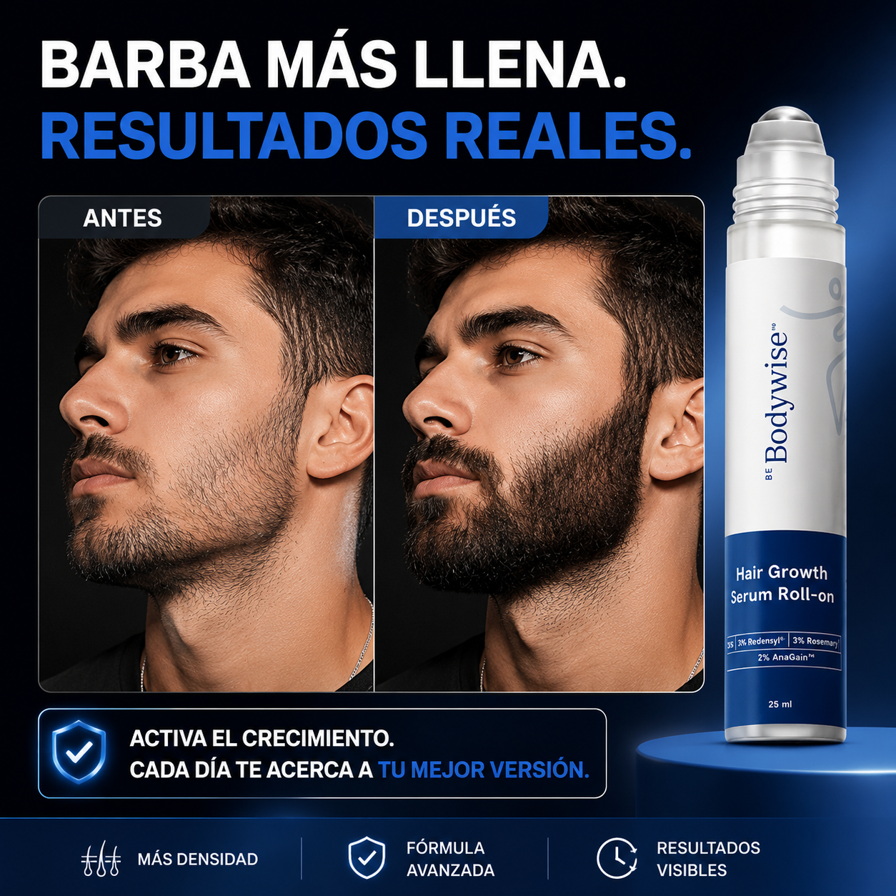 Serum BodyWise® - Tratamiento para Crecimiento y AntiCaída Capilar Masculino
