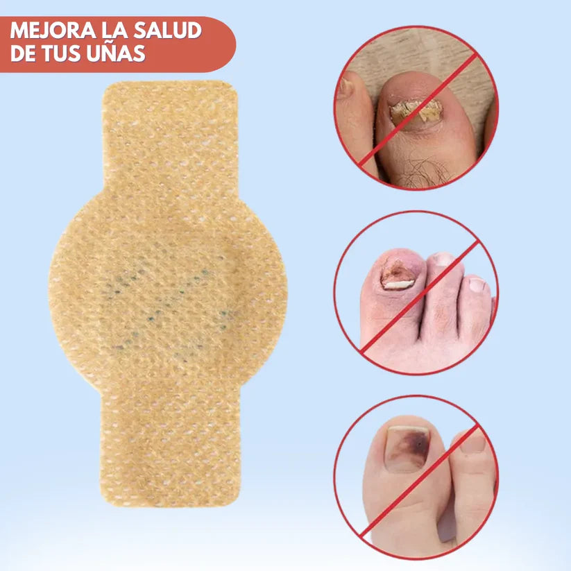 NeilPatch™ Parche Antifúngico para uña encarnada y hongo